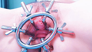 Speculum