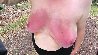Barefoot beating your breasts red while hiking