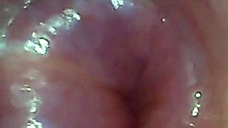 Endoscope POV: Test Tube Cock Urethral Insertion
